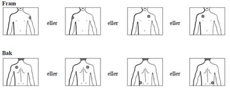 Norspan plåster placering